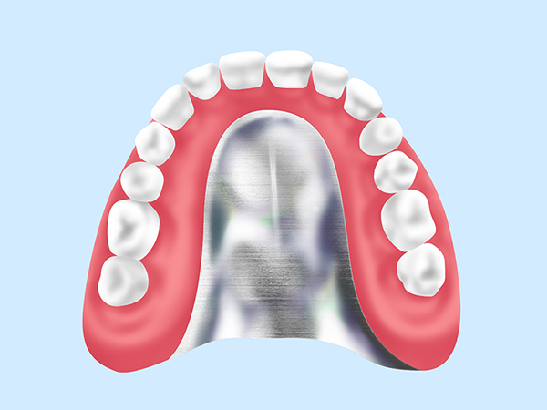 自費入れ歯
