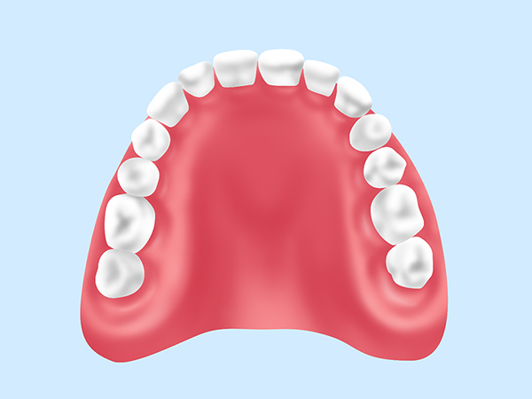 レジン床義歯